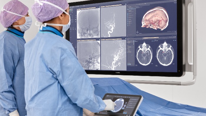 Tempo &eacute; c&eacute;rebro: novas tecnologias usam IA para ajudar casos de AVC