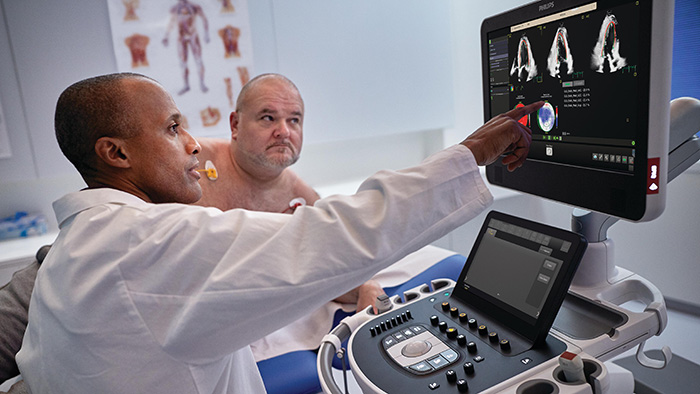 A Philips lan&ccedil;a o Transcend Plus para EPIQ CVx e Affiniti CVx, oferecendo qualidade de imagem inovadora e melhorias em IA aprovados pelo FDA para ultrassom cardiovascular